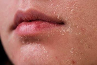 5 thay đổi trên da ''tố cáo'' cơ thể mắc bệnh nguy hiểm, chớ để lâu kẻo hối hận không kịp