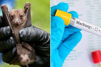 Virus Marburg làm 9 người tử vong sau khi dự lễ tang: Lây nhiễm thế nào, triệu chứng ra sao?