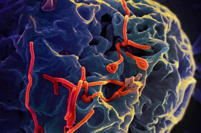 Bộ Y tế thông tin diễn biến phức tạp của dịch bệnh do virus Ebola