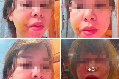 Người phụ nữ cầu cứu sau nhiều lần bị chồng hành hung
