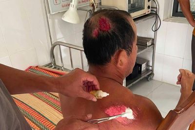 Ngư dân câm điếc bị tàu lạ tông chìm thuyền rồi bỏ mặc giữa biển
