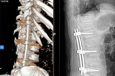 Điện giật khi sửa bóng đèn, người đàn ông ngã từ độ cao gần 4 m