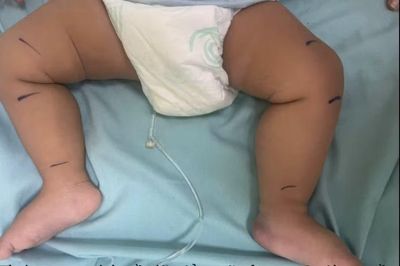 Rắn lục đuôi đỏ ẩn dưới xe đồ chơi, cắn bé 7 tháng tuổi