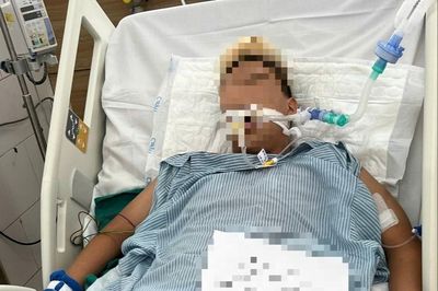 Dùng thuốc lá điện tử, nam thanh niên 17 tuổi nhập viện nguy kịch