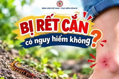 Cảnh báo rết cắn tăng cao tại Quảng Ninh, bác sĩ bày cách sơ cứu hiệu quả