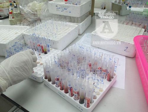 Các ống xét nghiệm được đánh mã số chi tiết
