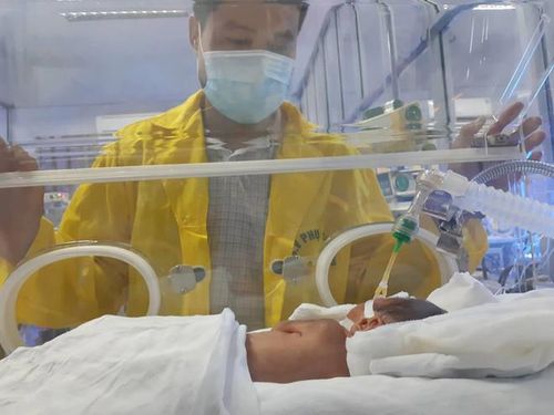 Bé Đỗ Bình An đang được chăm sóc tại Bệnh viện Phụ sản Trung ương. Ảnh: TH
