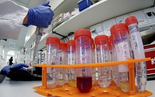  Cả thế giới đang chạy đua chế tạo vacxin ngừa virus corona