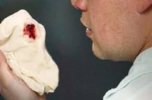 Nhiều nguyên nhân gây ho khạc ra máu.