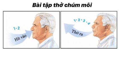 Kỹ thuật thở chúm môi giúp làm giảm khó thở khi bị COPD - Ảnh: Internet