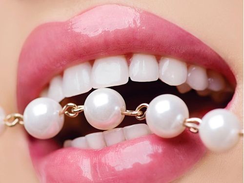  Mỗi lần thay mới mão sứ hoặc miếng dán sứ sẽ tốn khoản 20.000 USD. Ảnh: Elixir Cosmetics. 