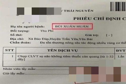 Vết thương trên vùng đầu Huấn "hoa hồng"