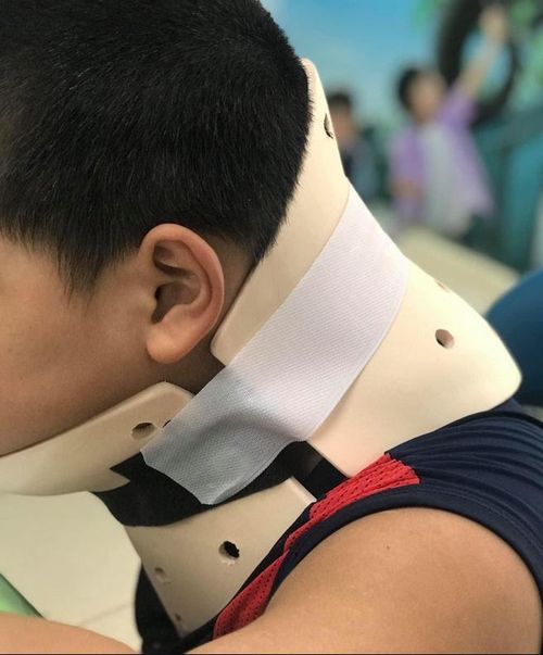 Bé trai 10 tuổi nhập viện điều trị chấn thương cổ 