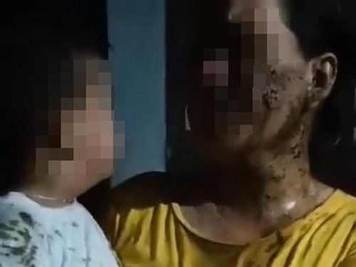 Mẹ con bà G. bị đổ phân lên người. Ảnh cắt từ clip