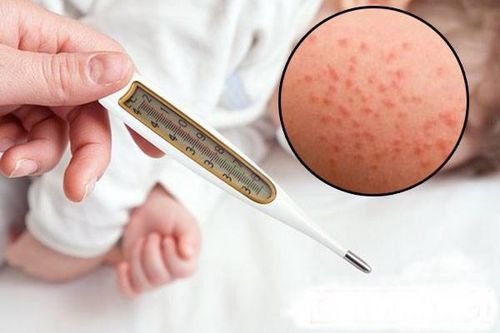 Khi bị bệnh bệnh nhân Rubella luôn cảm thấy mệt mỏi, chán ăn - Ảnh Internet