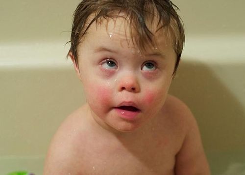 Lưu ý trẻ đang sốt cao khi mắc rubella tuyệt đối không được tắm gội cho trẻ - Ảnh Internet