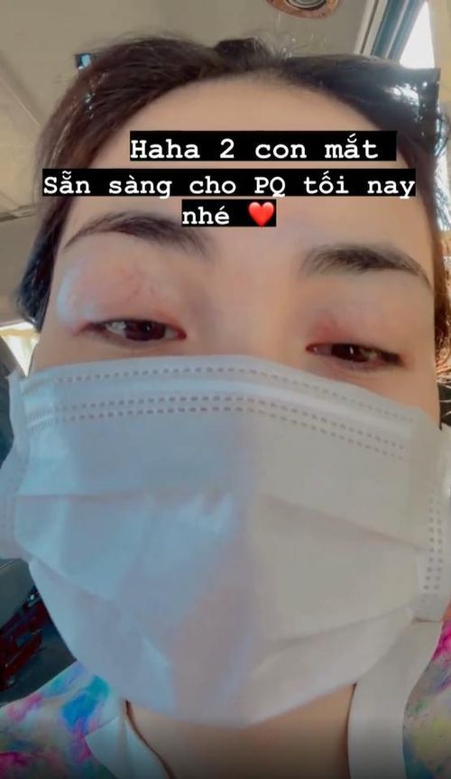 Hòa Minzy xuất hiện với đôi mắt sưng húp.