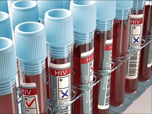 Tế bào B có thể sản sinh ra kháng nguyên ngừa virus HIV.