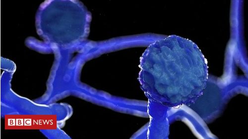 Nấm mucormycetes nhìn qua kính hiển vi. Ảnh: BBC