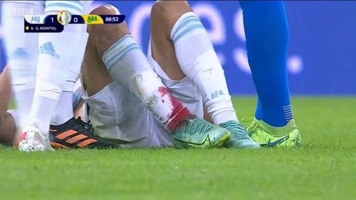 Việc Montiel đổ máu là hình ảnh tiêu biểu cho trận chung kết nhuốm màu bạo lực giữa Argentina và Brazil. (Ảnh: Zing).