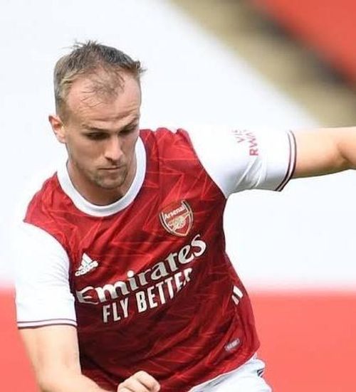 Holding thời điểm gia nhập Arsenal năm 2016 (bên trái). Theo thời gian, mái tóc của anh thưa dần. Ảnh: Sky Sports.