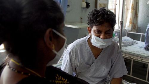 Ông Srinivas với mắt trái sưng vù và không thể mở mắt bình thường do dịch bệnh nấm đen. Ảnh: CNN.