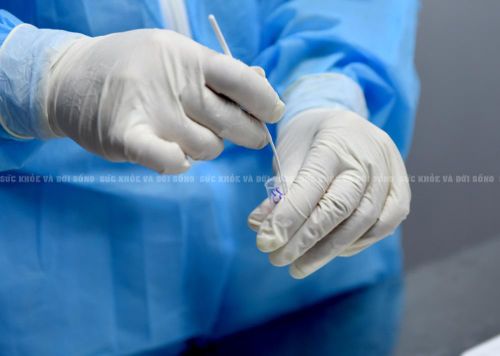 Thực hiện test nhanh SARS-CoV-2