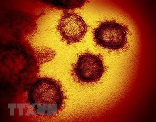 Hình ảnh dưới kính hiển vi từ viện y tế quốc gia Mỹ cung cấp cho thấy virus SARS-CoV-2 gây bệnh COVID-19 được phân lập và xuất hiện trên bề mặt tế bào của một bệnh nhân. (Ảnh: AFP/TTXVN)