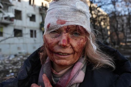 Một phụ nữ bị thương sau cuộc không kích bên ngoài thành phố Kharkiv của Ukraine hôm 24/2. Ảnh: Anadolu Agency.