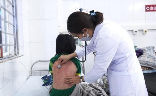 Trẻ mắc hội chứng MIS-C. (Ảnh: Suckhoedoisong.vn)