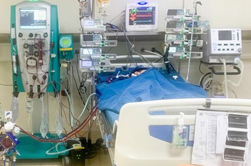 Bé Q. được lọc máu, chạy ECMO tại bệnh viện. Ảnh: Bệnh viện cung cấp.