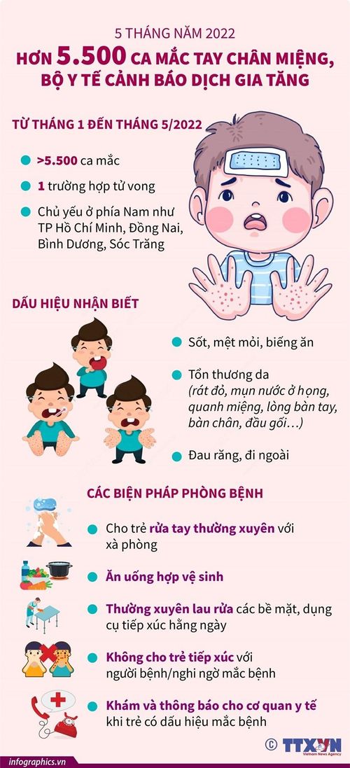Nhấp chuột để xem kích thước chuẩn.