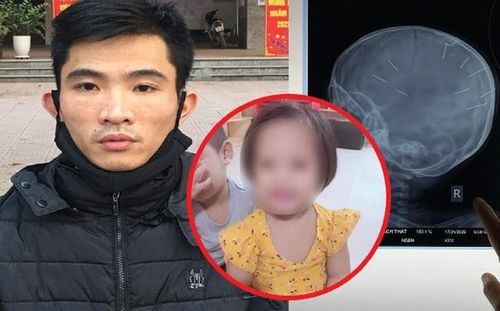 Mặc dù được các bác sĩ Bệnh viện Đa khoa Xanh Pôn tích cực chữa trị, nhưng đến 19h15 ngày 12/3, bé A. đã tử vong sau 2 tháng hồi sức tích cực. Nguyên nhân được xác định là tổn thương não do dị vật quá nặng. Liên quan đến vụ việc, ngày 20/1, Nguyễn Trung Huyên (SN 1992, trú tại xã Thạch Hòa, Thạch Thất, Hà Nội), người tình của mẹ cháu bé, bị khởi tố, bắt tạm giam thời hạn 4 tháng để điều tra về tội "Giết người". Huyên được xác định là nghi phạm nhiều lần hành hạ bé N.A., trong đó có việc cắm đinh vào đầu cháu. 