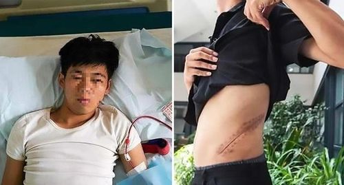 Suốt 11 năm qua, Vương phải nằm liệt giường mà không thể ngồi dậy và phải chạy thận mỗi ngày để lọc chất độc trong máu. 