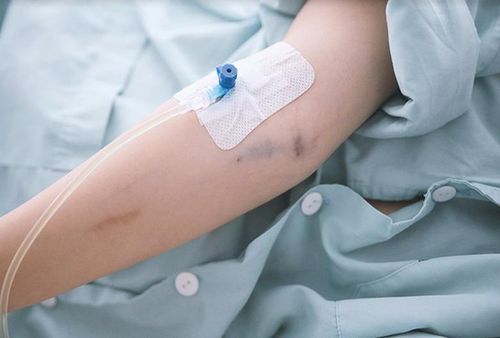 Chỉ truyền dịch tại cơ sở y tế, khi cần thiết.