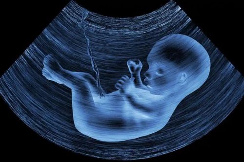  Hạt vi nhựa đã được tìm thấy trong máu người, nhau thai, phân của trẻ sơ sinh. Ảnh: Guardian. 