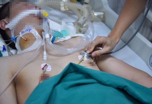 Một bệnh nhân phải nhập viện do sốc nặng sau khi mắc sốt xuất huyết. Ảnh: Trương Hiếu.