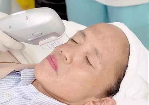 Trước đó vào cuối tháng 10 vừa qua, trên trang cá nhân, Hưng Vlog gây tranh cãi khi khoe ảnh đưa mẹ là Bà Tân Vlog đến một cơ sở thẩm mỹ để làm đẹp với dòng trạng thái: "Cứ ngỡ bà mới tuổi đôi mươi".