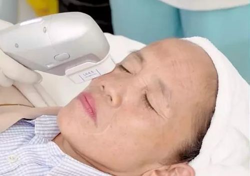 Tuy nhiên, bên cạnh những lời ngợi khen, một số người xem lại cho rằng gương mặt của hiện tượng mạng này có phần thiếu tự nhiên hậu làm đẹp.