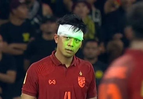 Pansa Hemviboon bị tia laser chiếu thẳng vào mặt.
