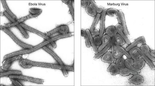 Virus Ebola và virus Marburg.