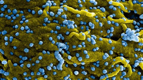 Tên của virus được lấy từ phòng thí nghiệm Marburg nước Đức - nơi phát hiện ra loại virus này vào năm 1967
