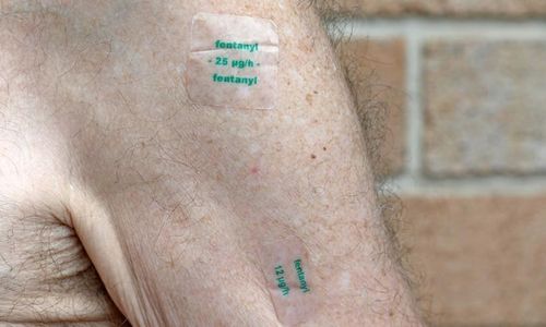 Miếng dán giảm đau fentanyl có tác dụng mạnh gấp nhiều lần morphin.