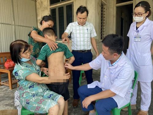 Ngành Y tế Hà Tĩnh cử cán bộ xuống trực tiếp địa phương để tìm hiểu nguyên nhân, xác định loại và xử lý nguồn bệnh. (Ảnh: SYT Hà Tĩnh).