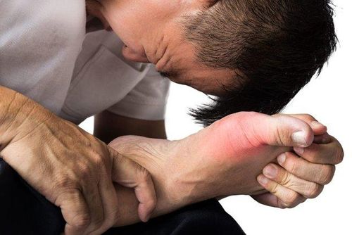 Nếu không được điều trị kịp thời, bệnh gout có thể gây biến dạng xương khớp, giảm chức năng vận động, thậm chí dẫn tới tàn phế.