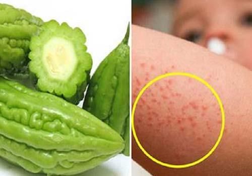 Mướp đắng thanh nhiệt, giải độc, ngăn ngửa trẻ bị rôm sảy.