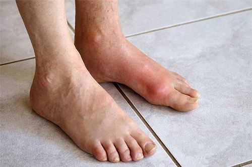 Ảnh minh họa. Nguồn ảnh: Internet
