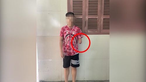 Một đối tượng SN 2008, bị mất một tay nhưng vẫn tham gia đua xe ở Long Biên