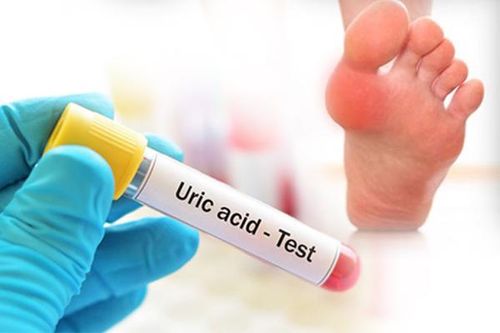 Ngoài bệnh gout còn nhiều nguyên nhân khác có thể dẫn tới nồng độ acid uric trong máu tăng cao.