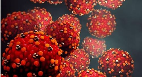 VIrus gây bệnh sởi.